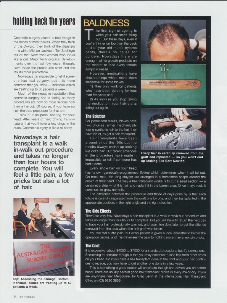 Article page discussing hair transplants and clinic consultations with procedure photos.
